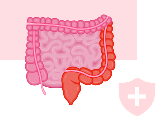 Индекс Мейо