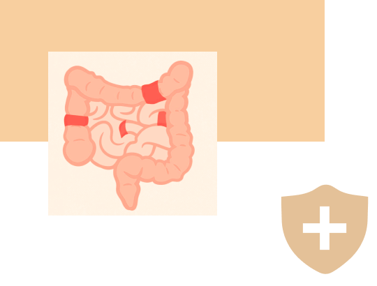 Индекс Беста