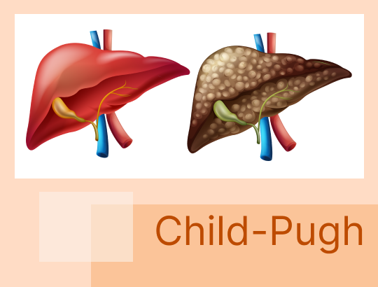 Шкала Child-Pugh